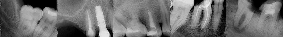 teeth.jpg teeth.jpg
